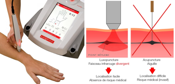 luxopuncture acupuncture libourne
